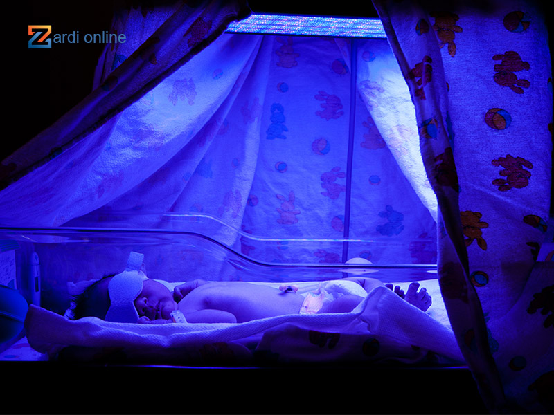 کودک خوابیده در دستگاه زردی نوزاد 