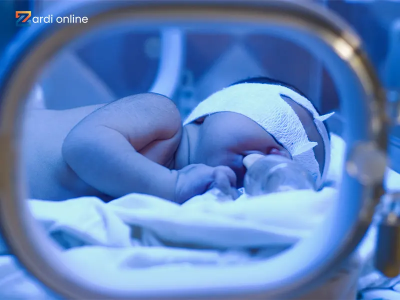 نوزاد در داخل دستگاه فتوتراپی