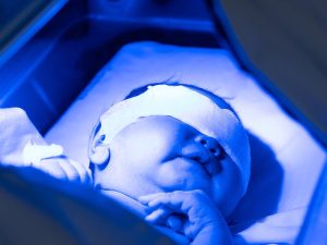 مراکز تست زردی نوزاد با دستگاه در شرق تهران