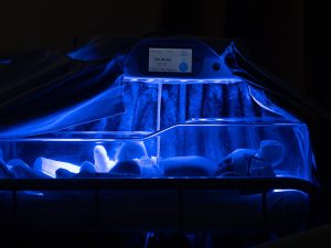 نوازد مبتلا به زردی زیر بهترین دستگاه زردی نوزاد