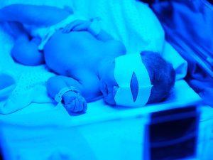 نوزاد مبتلا به زردی در بیمارستان