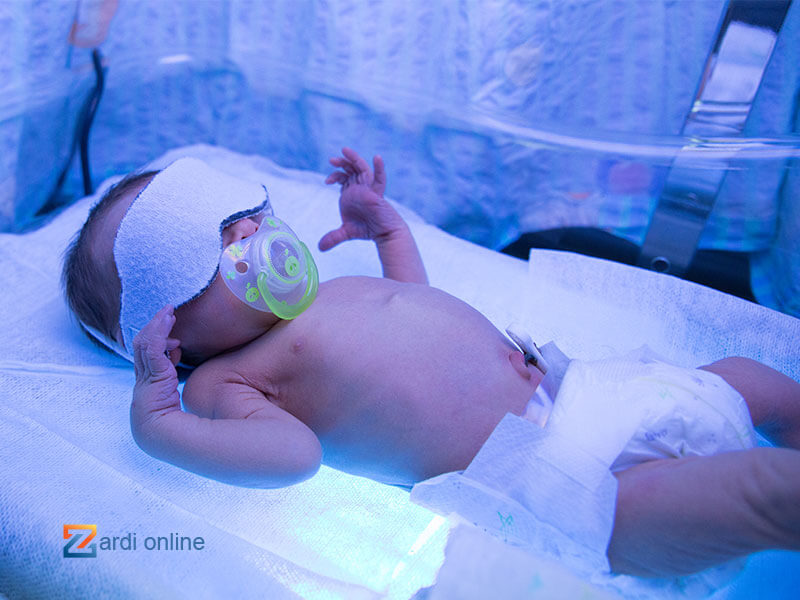 تصویری از نوزاد درون دستگاه فتوتراپی