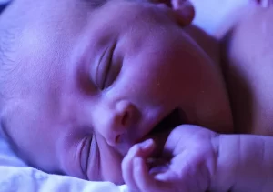 کودک مبتلا به زردی در حال خواب