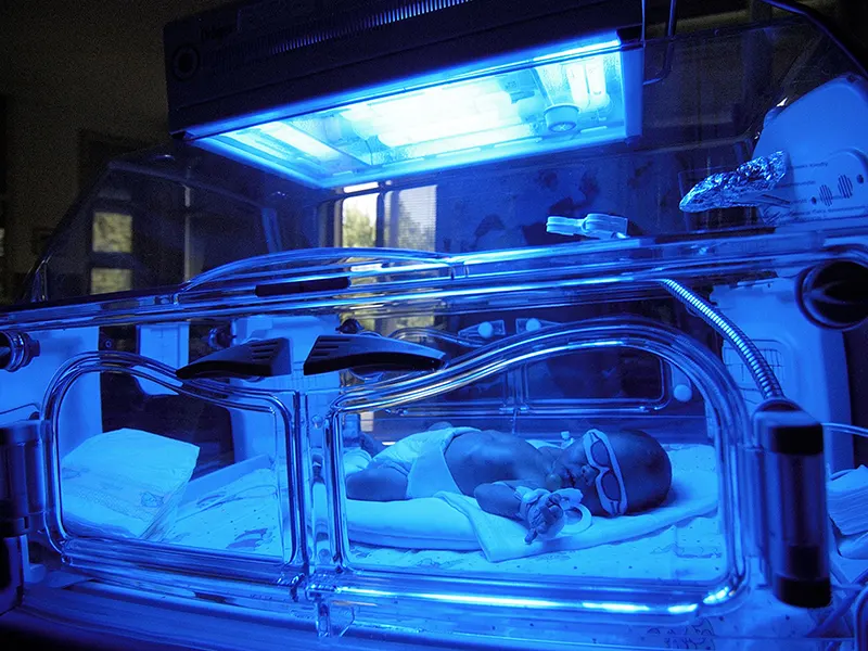 نوزاد مبتلا به زردی داخل دستگاه فتوتراپی