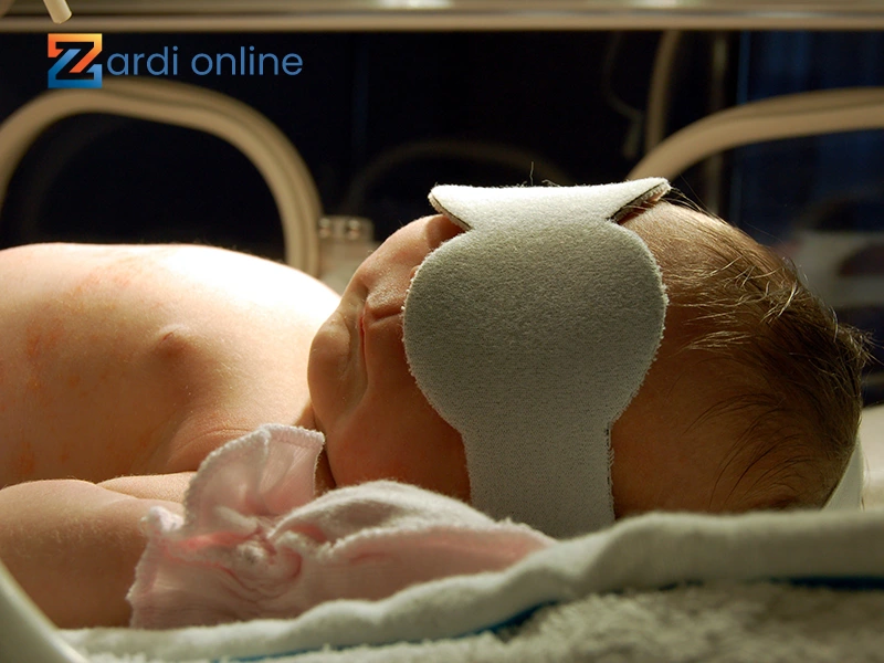 کودک با چشم‌بند در دستگاه زردی نوزاد