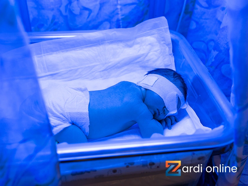 نوزاد با چشم‌بند در حال خوابیدن در دستگاه زردی نوزاد