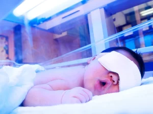 عکس دستگاه زردی نوزاد به همراه نوزاد