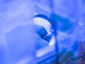 نوزاد در حین درمان درون دستگاه زردی