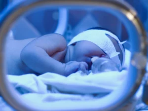 دستگاه فتوتراپی و نوزاد در حال درمان زردی